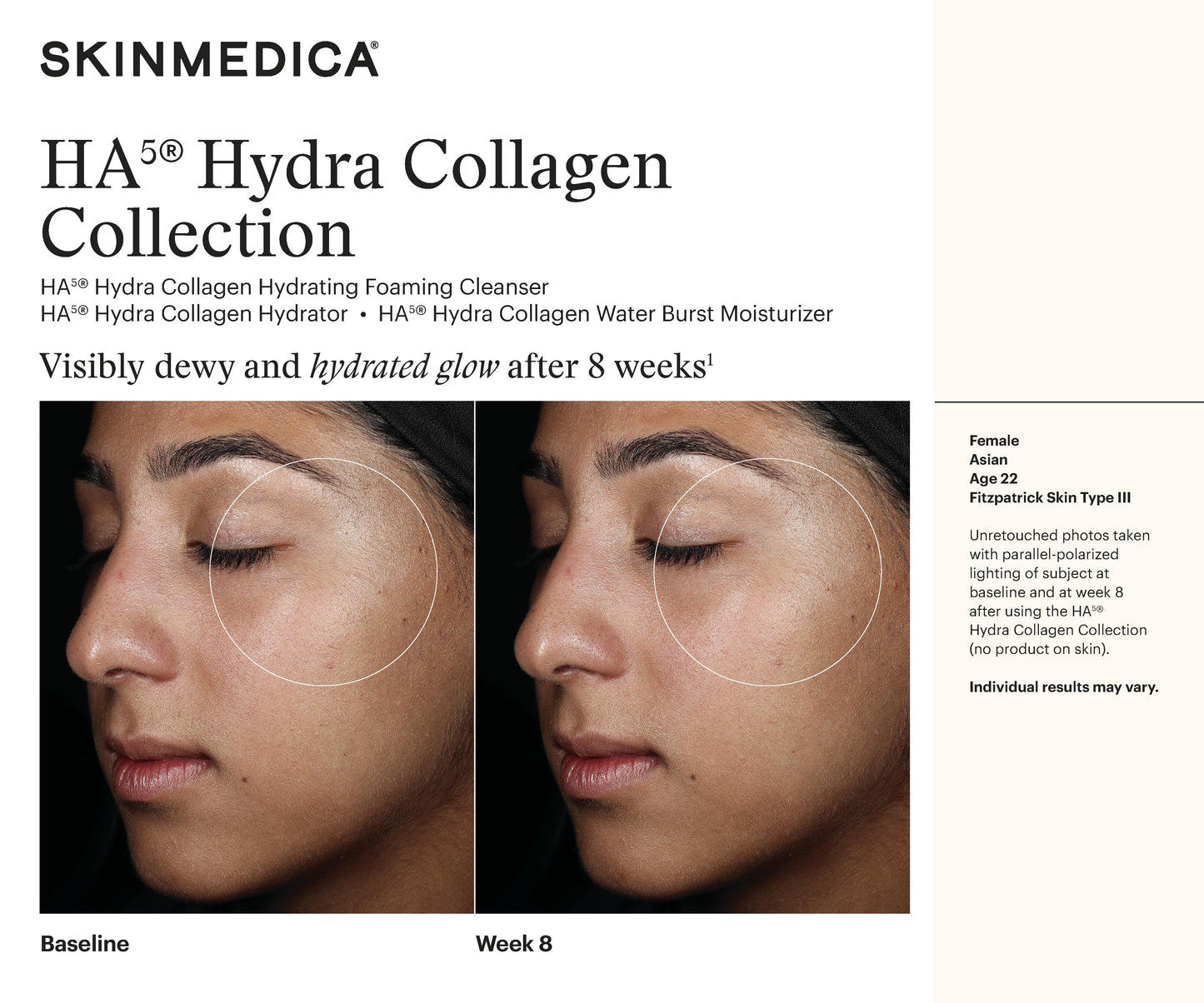 HA5 Hydra Collagen Trio