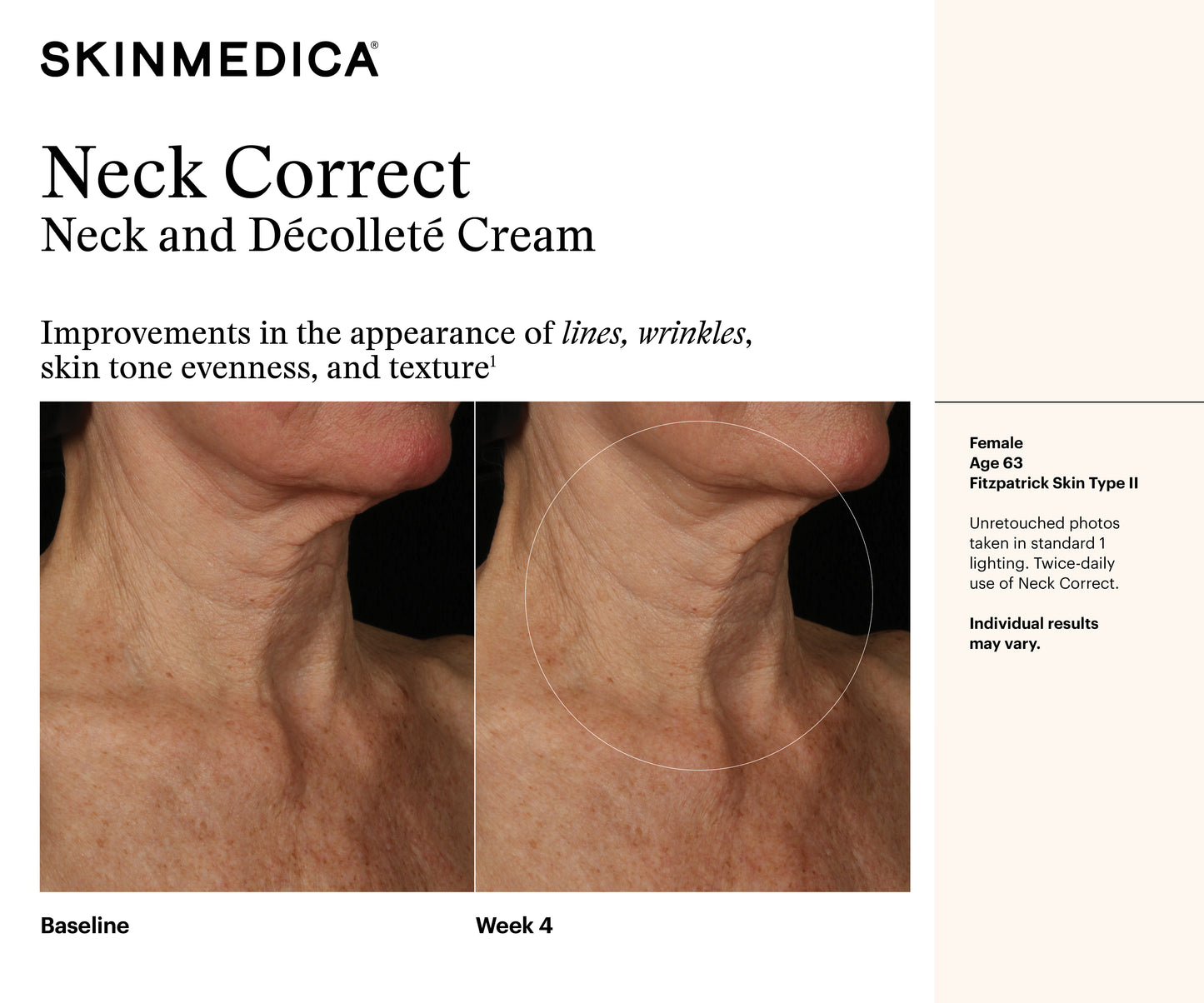 Neck Correct Cream