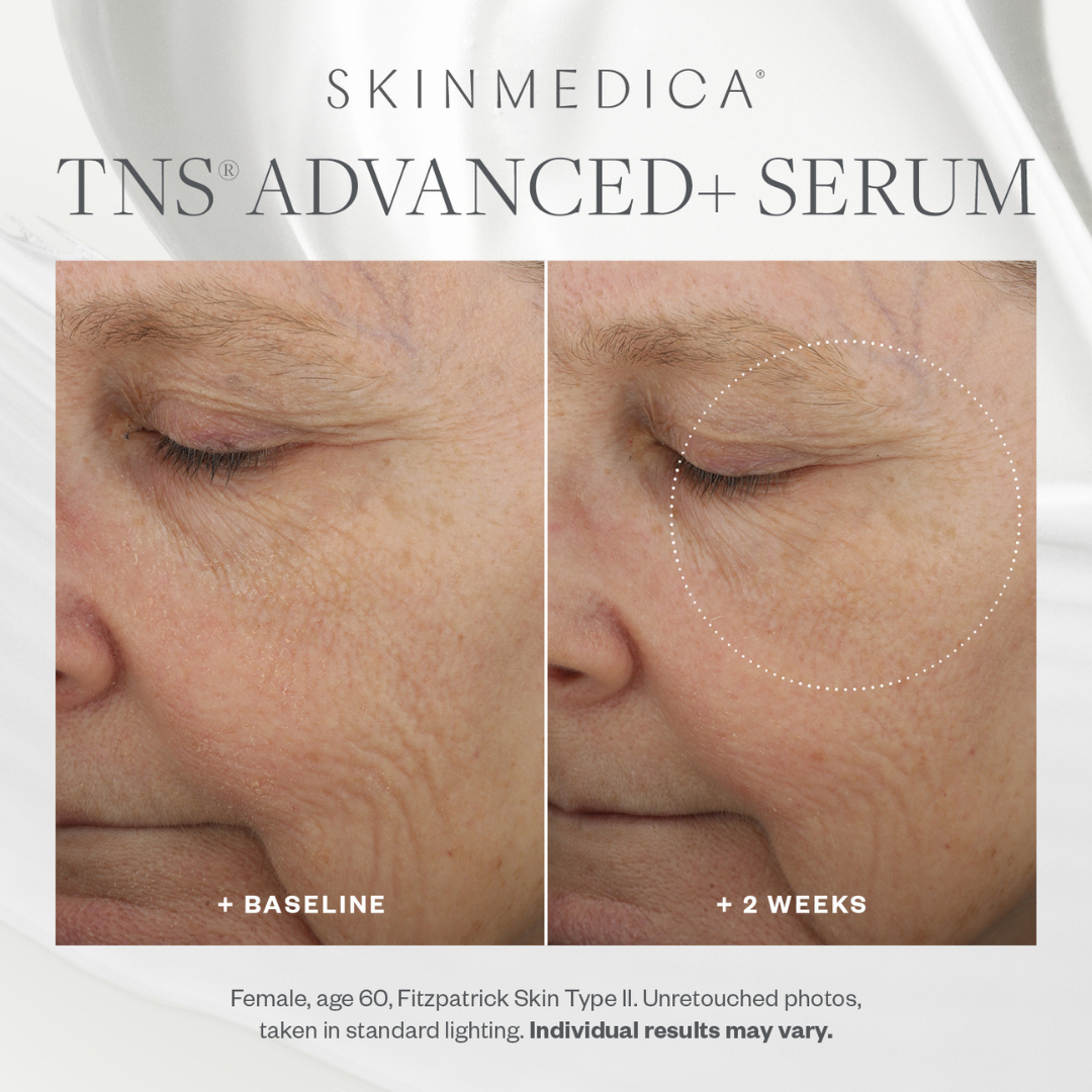 TNS Advanced + Serum