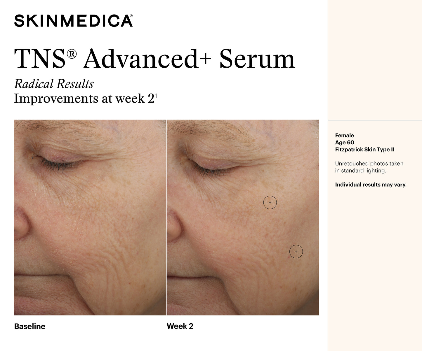 TNS Advanced+ Serum