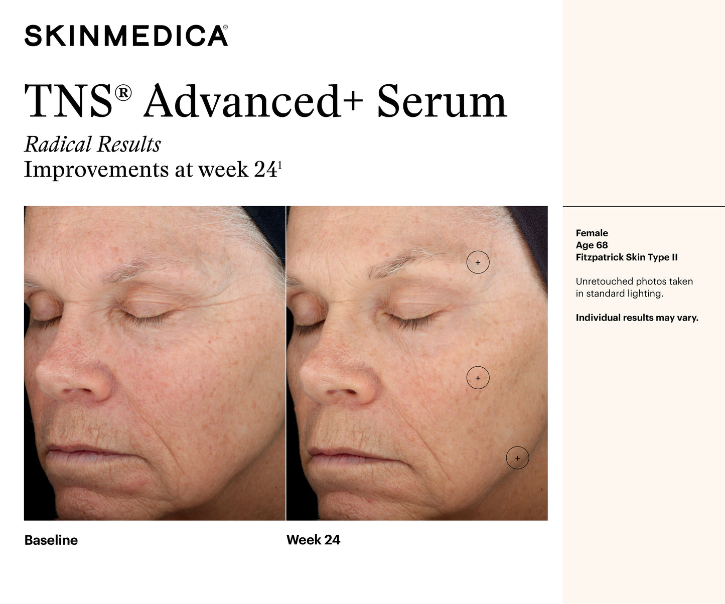 TNS Advanced+ Serum