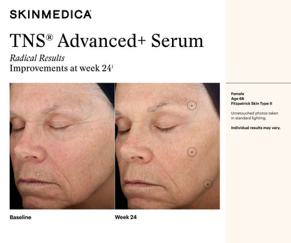 TNS Advanced+ Serum