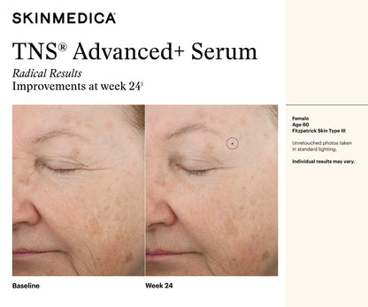 TNS Advanced+ Serum