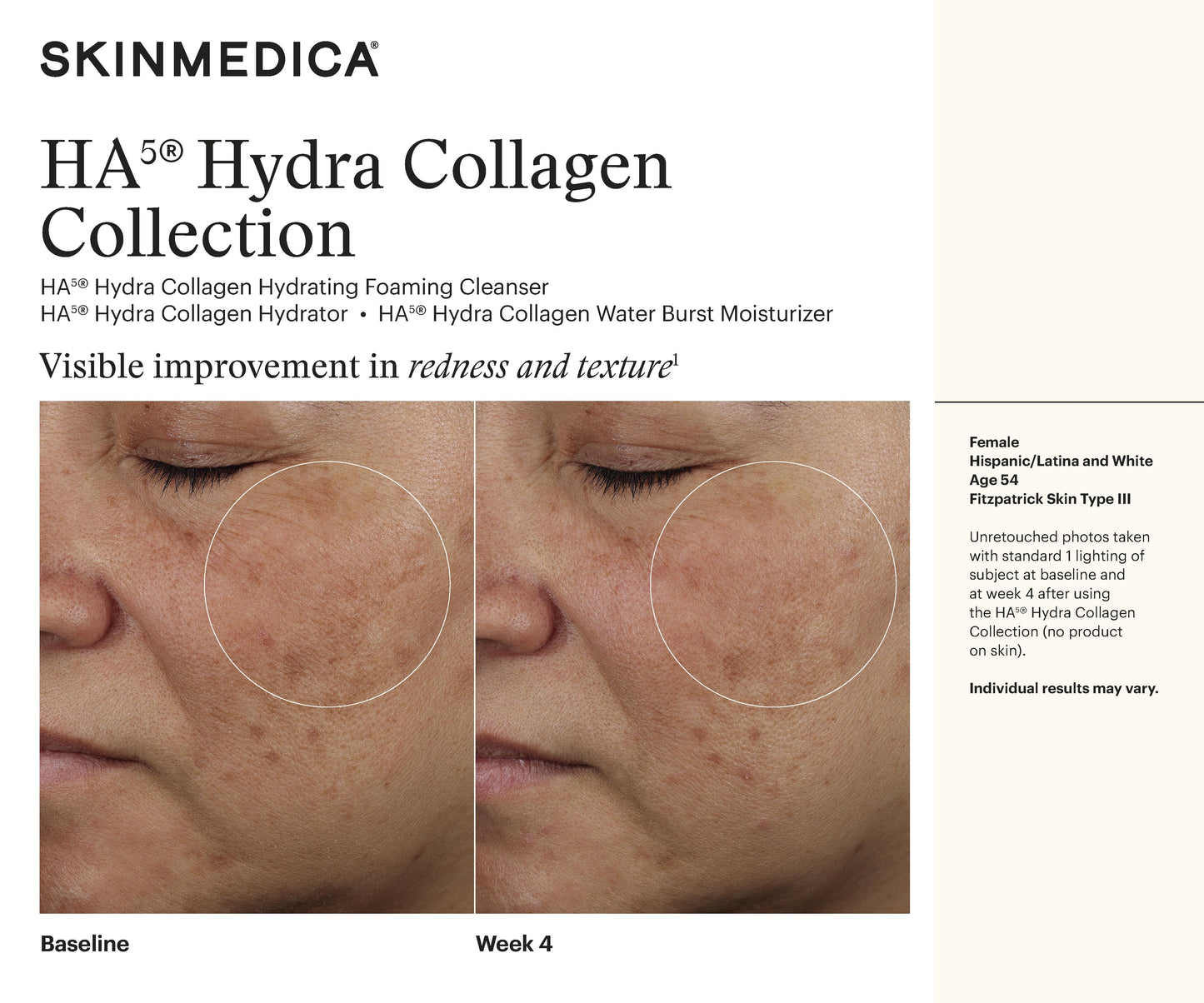 HA5 Hydra Collagen Trio
