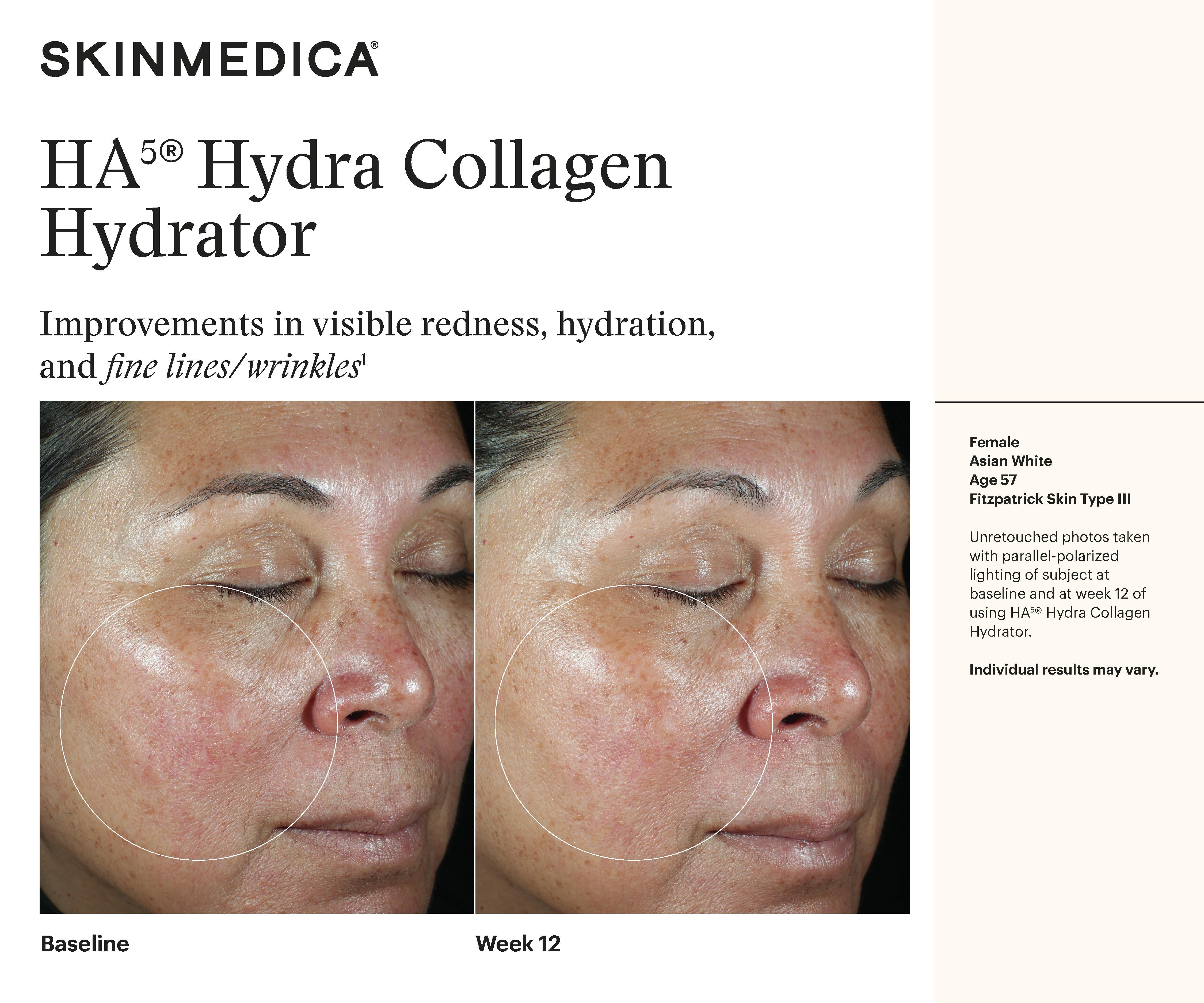 HA5 Hydra Collagen Hydrator – Soul Aesthetics