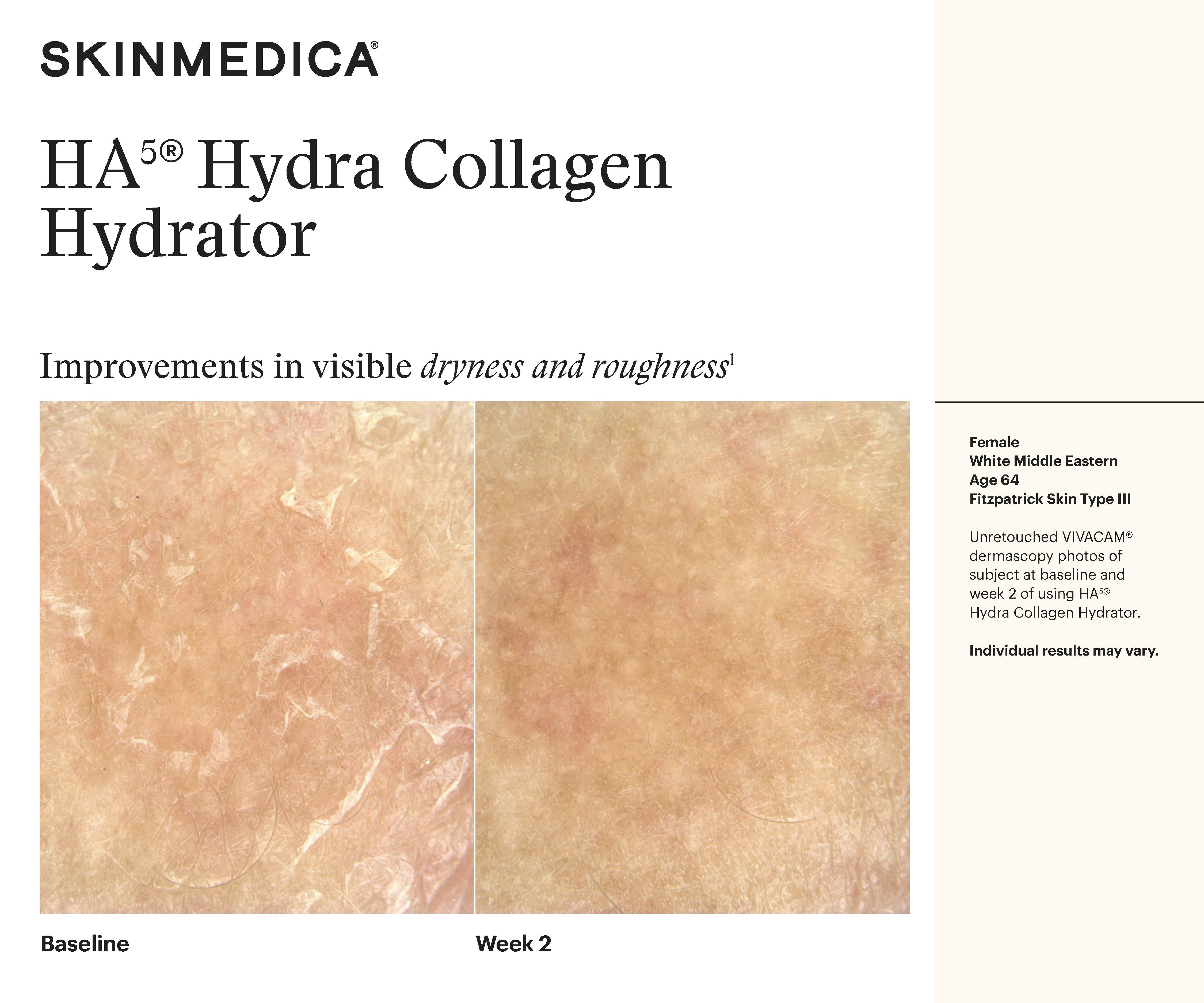 HA5 Hydra Collagen Hydrator – Soul Aesthetics