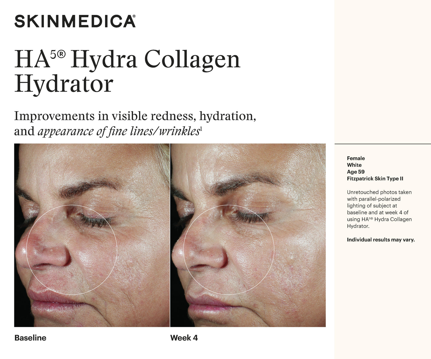 HA5 Hydra Collagen Hydrator