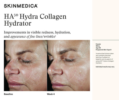 HA5 Hydra Collagen Hydrator